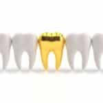 Das Sparbuch “krallt” das Jobcenter – den Goldzahn auch? 3 Das Sparbuch “krallt” das Jobcenter – den Goldzahn auch?