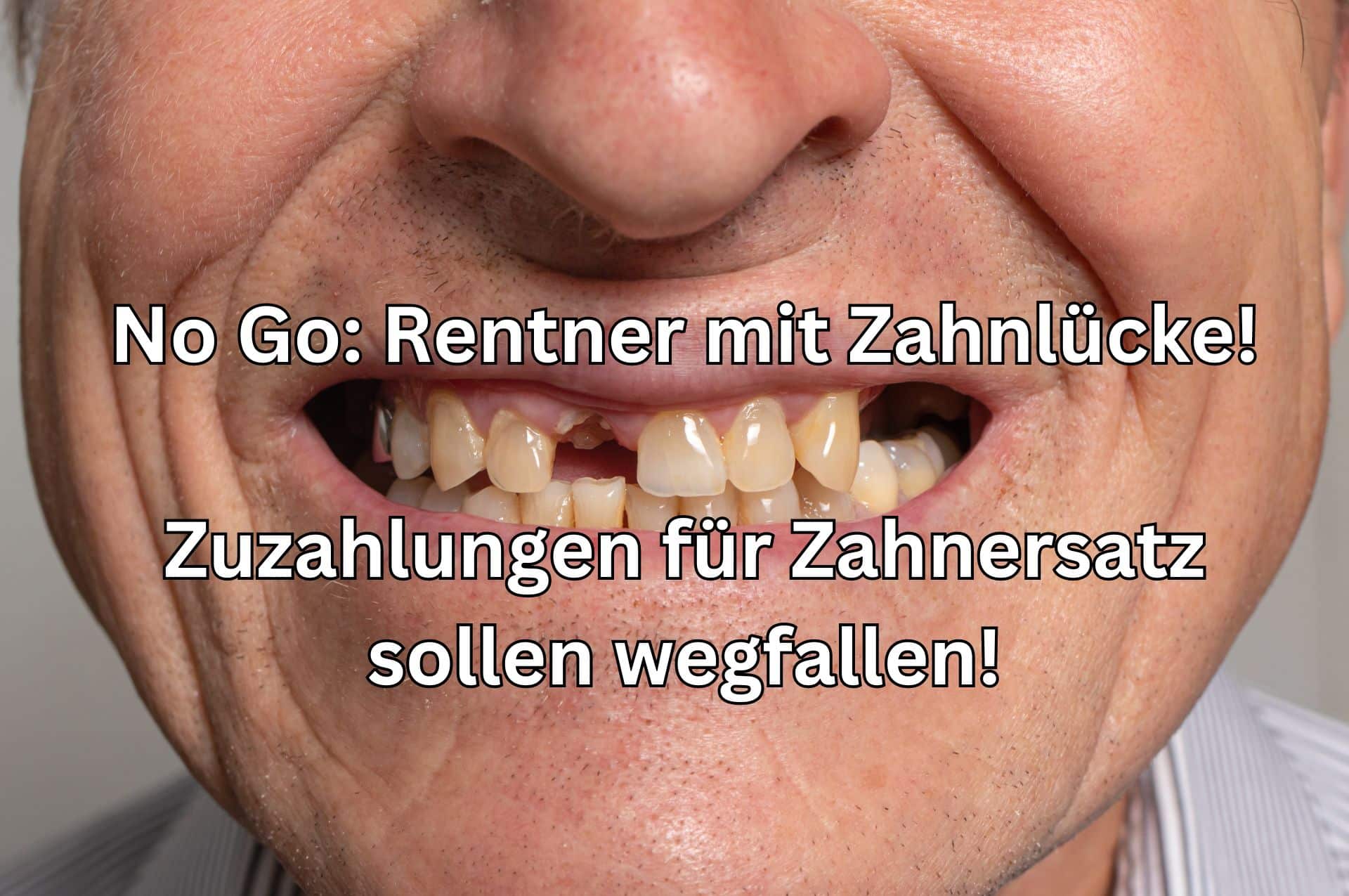 Die Linkspartei fordert die Abschaffung der Zuzahlungen für Rentner zu Zahnersatz, Brille oder Hörgerät.